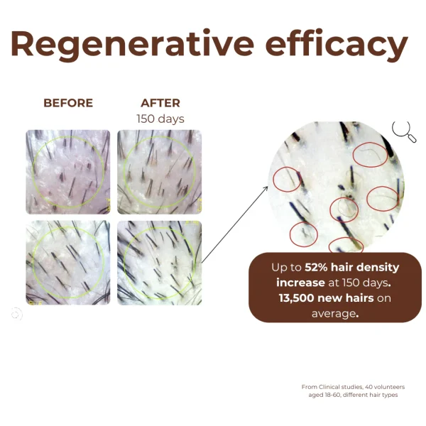 Standard Beauty | Peptide Miracle Hair Growth Serum with Rosemary Extract & Plant-Stem-Cells - Image 3